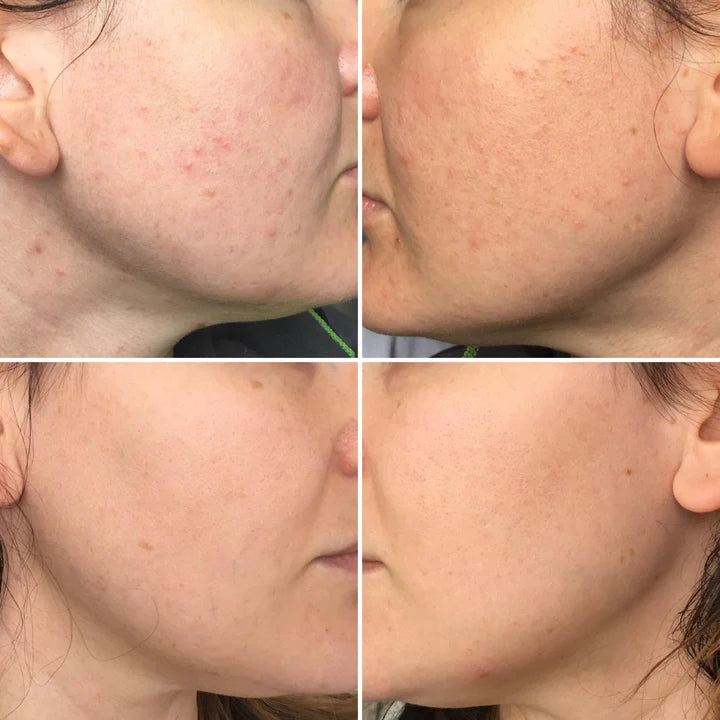 Orange Glow Enzyme Gel (100g)