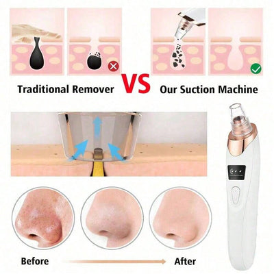 Electric Acne Pore Cleaner &amp; Blackhead Remover